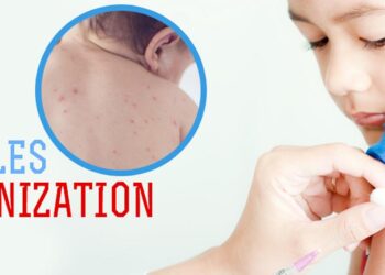 ٹیکہ ہی کرے گا خسرہ روبیلا سے بچوں کی حفاظت