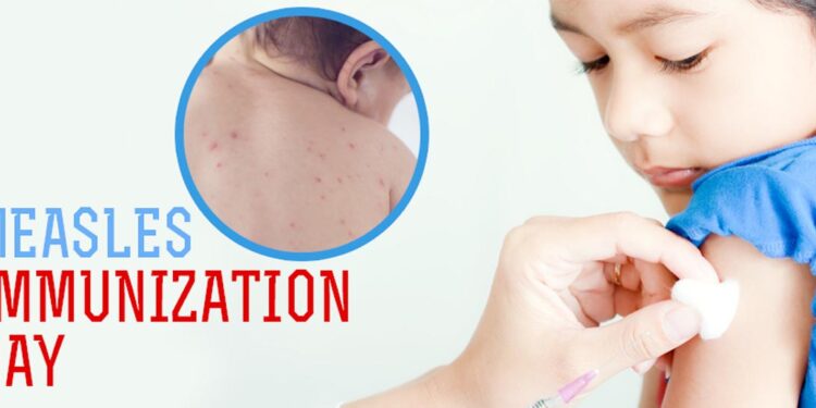 ٹیکہ ہی کرے گا خسرہ روبیلا سے بچوں کی حفاظت