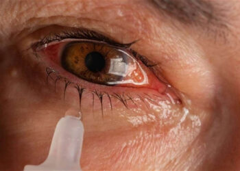 گرمی سے آنکھوںکے مریض بڑھے