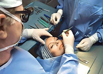 خوبصورتی کیلئے کاسمیٹک سرجری کروانے والی خواتین کیلئے ایران کا بڑا اعلان