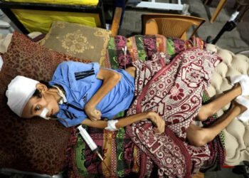 غزہ میں غذائی قلت سے اموات کا سلسلہ تیز ہوگیا