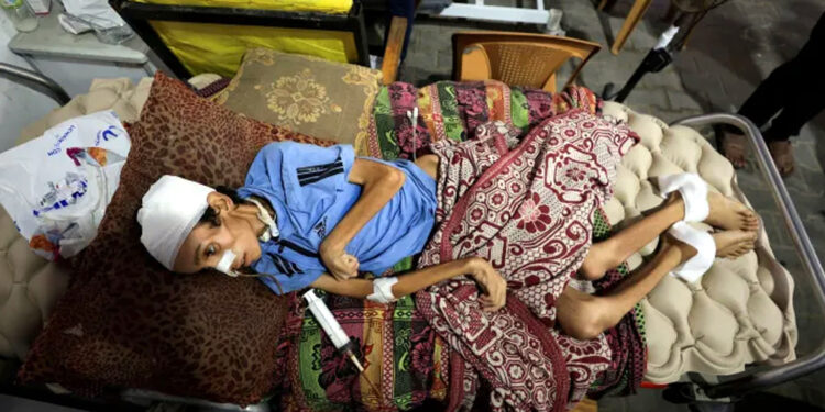 غزہ میں غذائی قلت سے اموات کا سلسلہ تیز ہوگیا