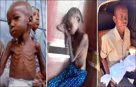 شہر الفاشر میں قحط کے باعث انسانیت کی بقا کو خطرہ